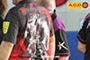 ACD23-0140